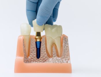 kunigami odontologia - clínica odontológica em niterói - dentista em niteroi