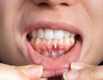 kunigami odontologia - clínica odontológica em niterói - dentista em niteroi